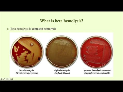 alpha vs beta hemolytic|Alpha Hemolysis vs. Beta Hemolysis .